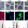 Analysis of the 2022 mpox virus using human keratinocytes and human iPS cell-derived colon organoids