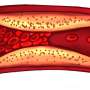 New anticoagulants may help treat sepsis and COVID-19