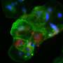 How COVID-19 crosses the placenta: Study uses lab-grown placental tissue to model infection