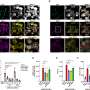 SARS-CoV-2 infects liver, stimulating glucose production and contributing to severe form of COVID-19, study shows