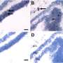 SARS-CoV-2 infects ocular tissue, but inflammation absent in the eyes of patients who died from COVID-19: Study