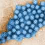 What to know about norovirus