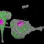 COVID-19: The persistence of SARS-CoV-2 in the lungs and the role of innate immunity