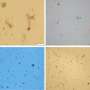 Australians are washing microplastics down the drain and it’s ending up on farms
