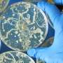 Fewer cases of fungal diseases coincided with start of COVID-19