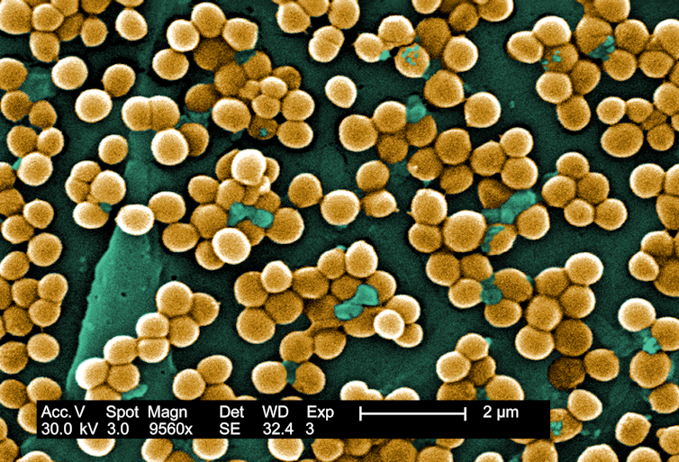 Infections after surgery are more likely due to bacteria already on your skin than from microbes in the hospital − new research