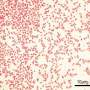 Peptide cocktails show promise in combating antibiotic resistance