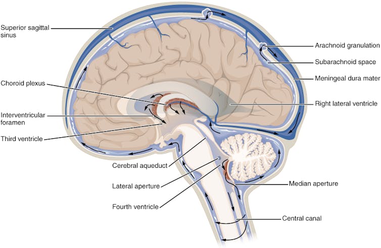 Fluid keeps your brain from crushing itself and shields your spine from shock – a neurologist explains what happens when it stops working