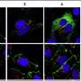 Study unveils novel treatment for blocking SARS-CoV-2 entry into cells