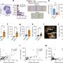 Immune pathways can prevent lung healing after viral infection, study shows