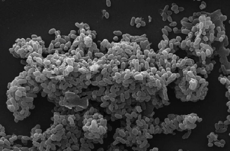 Gut microbe imbalances could predict a child’s risk for autism, ADHD and speech disorders years before symptoms appear