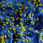 Six-country study investigates drug-resistant bacteria on hospital surfaces
