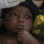 UN authorizes first mpox vaccine for children in an attempt to control Congo outbreak