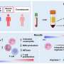 Exploring role of understudied dysfunctional immune cells in severe COVID-19