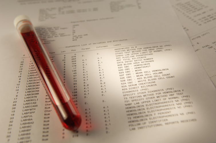 Blood tests are currently one-size-fits-all − machine learning can pinpoint what’s truly ‘normal’ for each patient