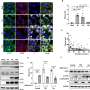 How SARS-CoV-2 exploits human proteins to replicate