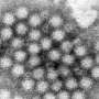 Norovirus outbreaks sweep California