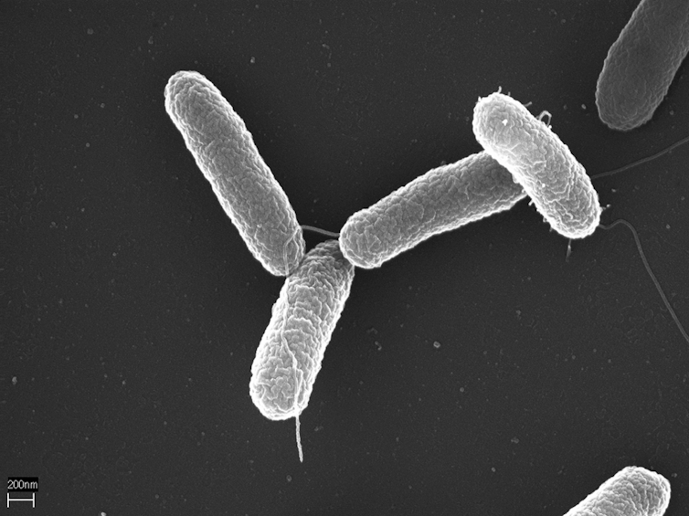 Contaminated milk from one plant in Illinois sickened thousands with ‘Salmonella’ in 1985 − as outbreaks rise in the US, lessons from this one remain true