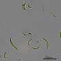 Microalgae remove antibiotic residues from wastewater, reducing environmental contamination