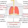 Study highlights microRNAs as key regulators in Klebsiella pneumoniae infections