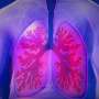 Appropriate diagnosis of COPD can have significant public health impact