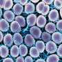 Genetic mechanisms promote antimicrobial resistance in gonorrhea