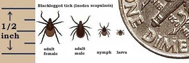 Warmer temps bring soaring tick populations – here’s how to stay safe from Lyme disease