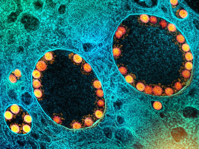 First mRNA flu shot approved by FDA bodes well for improving drugs of the future – though a few hurdles remain before mRNA can move beyond vaccines