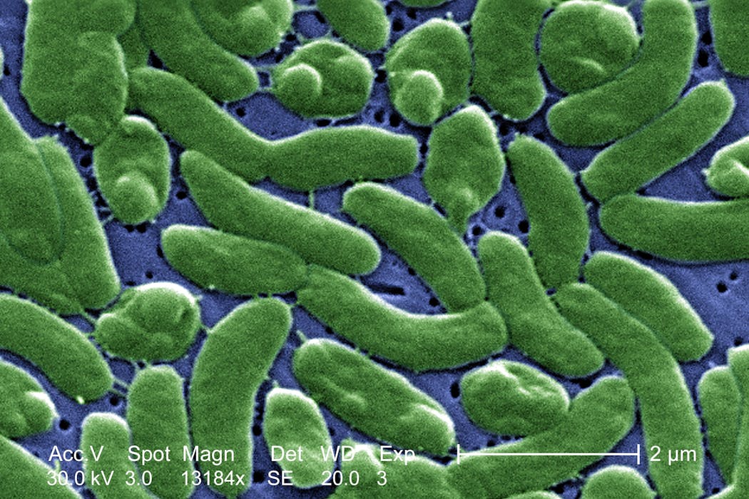 Flesh-eating bacteria are devouring limbs in warming waters worldwide − here’s how to protect yourself