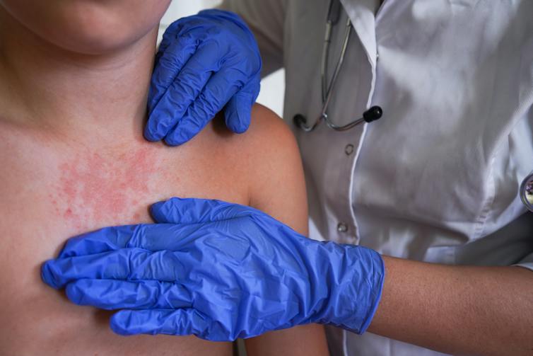 CDC vs. Pennsylvania: Why conflicting public health messages jeopardize public safety